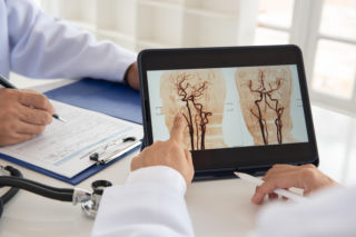 Czy kontrast uszkadza nerki? Naukowcy z Uniwersytetu Medycznego we Wrocławiu mają odpowiedź