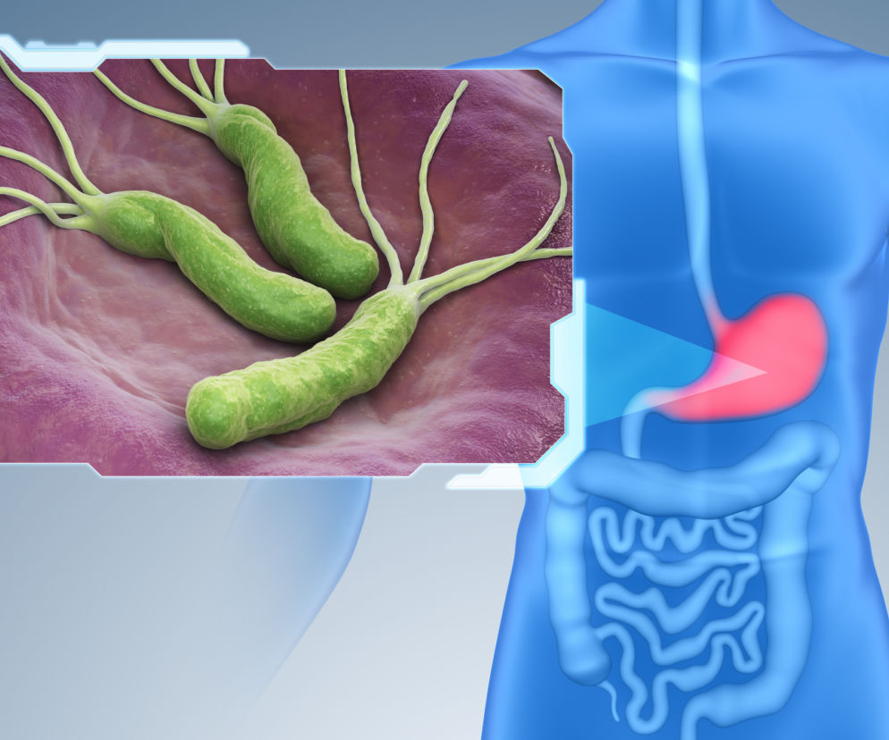 Helicobacter pylori
