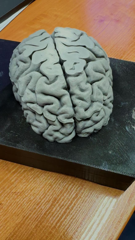 Na KUL-u drukują ludzki mózg. Tak uczą anatomii w 3D!