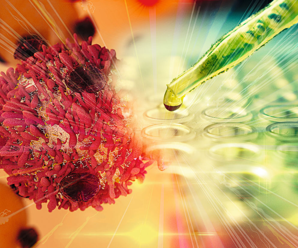 immunoonkologia