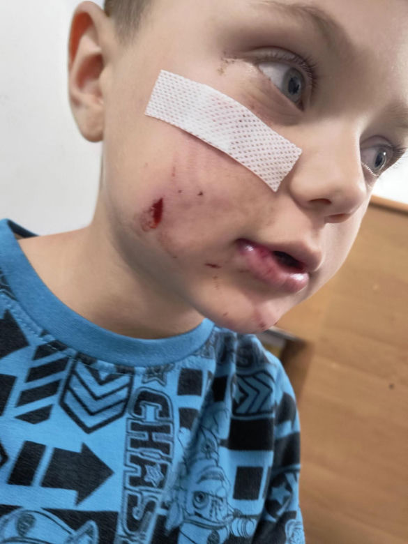 Pogryziony Franek potrzebuje pomocy. Policja szuka właściciela psa. Do szpitala dotarła anonimowa wiadomość