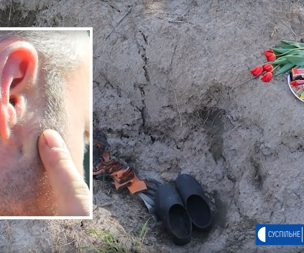 33-letni Mykoła: Rosjanie postrzelili mnie w głowę i razem z braćmi wrzucili do masowego grobu