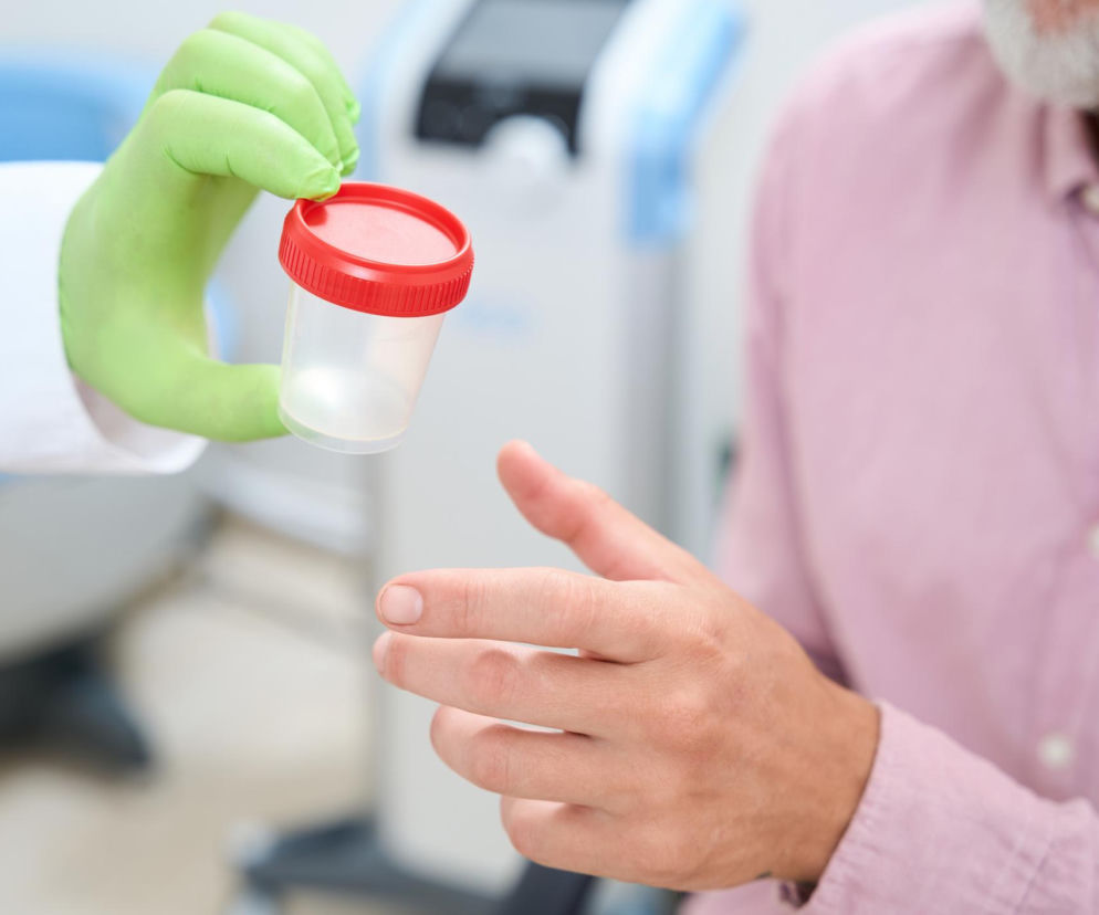 Dłoń osoby w zielonej rękawiczce i białym fartuchu podaje pojemnik na mocz z czerwoną zakrętką dłoni pacjenta w różowej koszuli. Obraz symbolizuje diagnostykę raka pęcherza moczowego, o której przeczytasz na Poradniku Zdrowie.