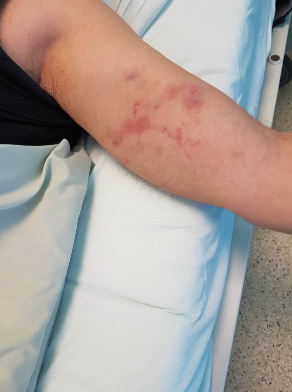 Dostałem zawału przez policję