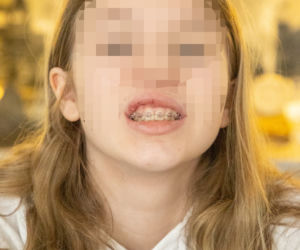 Przerażająca bójka nastolatek w Pruszkowie