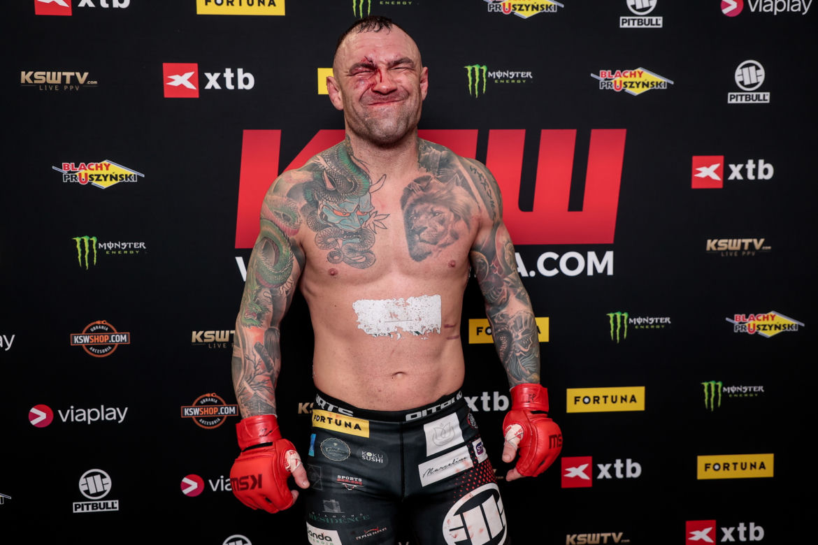 Paczuski: Potworne rozcięcie na twarzy gwiazdy KSW