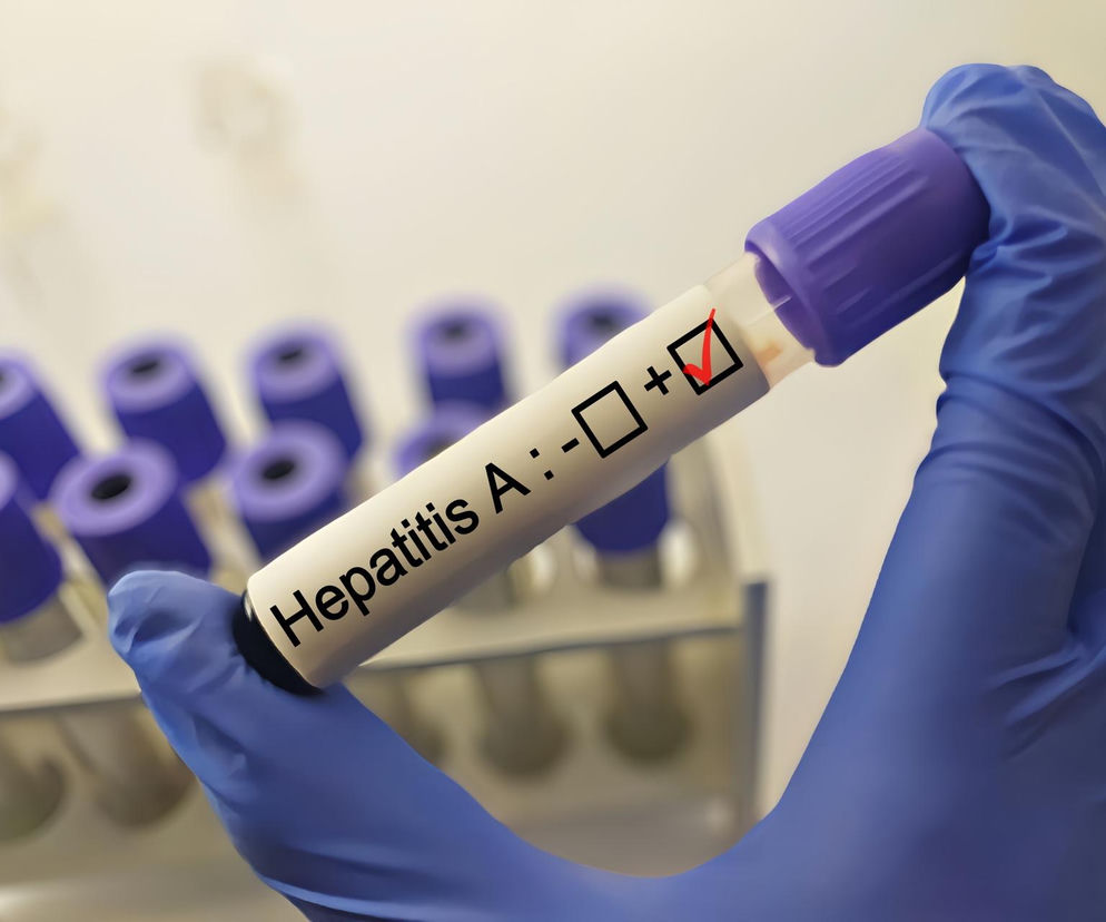 Ostrzeżenie przed podróżą do Czech! Polski MSZ mówi o wirusie