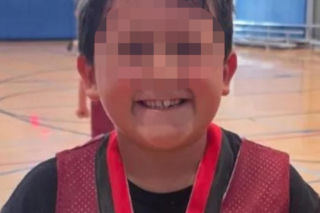 Wsadził do mikrofali plastik, eksplodował mu na twarz. 9-latek oszpecony na zawsze. Nowy niebezpieczny trend