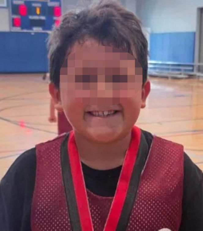 Wsadził do mikrofali plastik, eksplodował mu na twarz. 9-latek oszpecony na zawsze. Nowy niebezpieczny trend