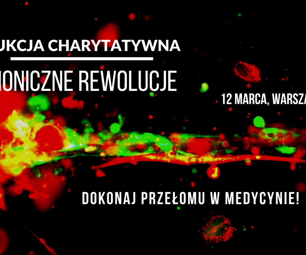 Aukcja charytatywna - zdjęcie główne