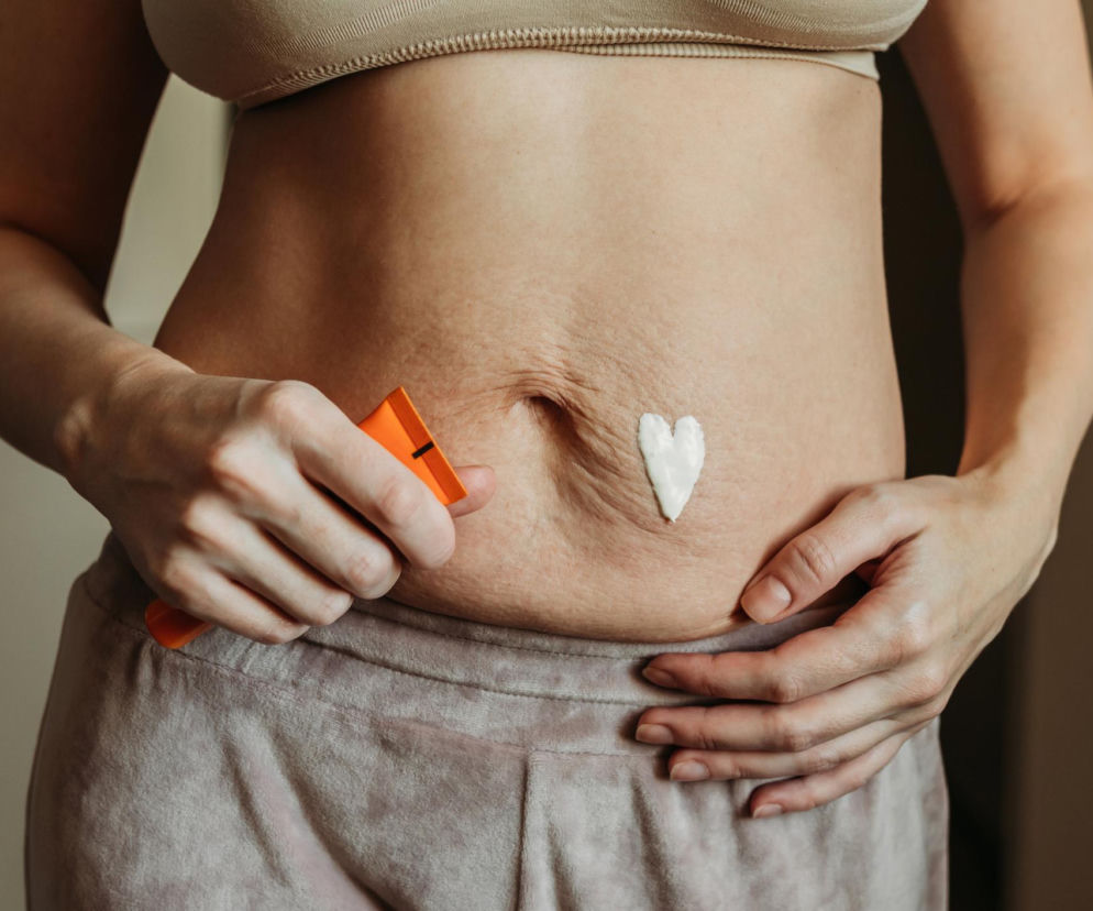 Zwiotczała skóra na brzuchu po ciąży? Te techniki masażu i składniki to przełom w ujędrnianiu