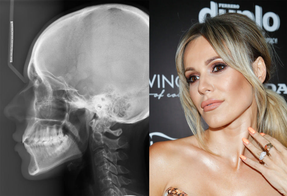 Doda udowodniła, że nie miała operacji plastycznych na twarzy