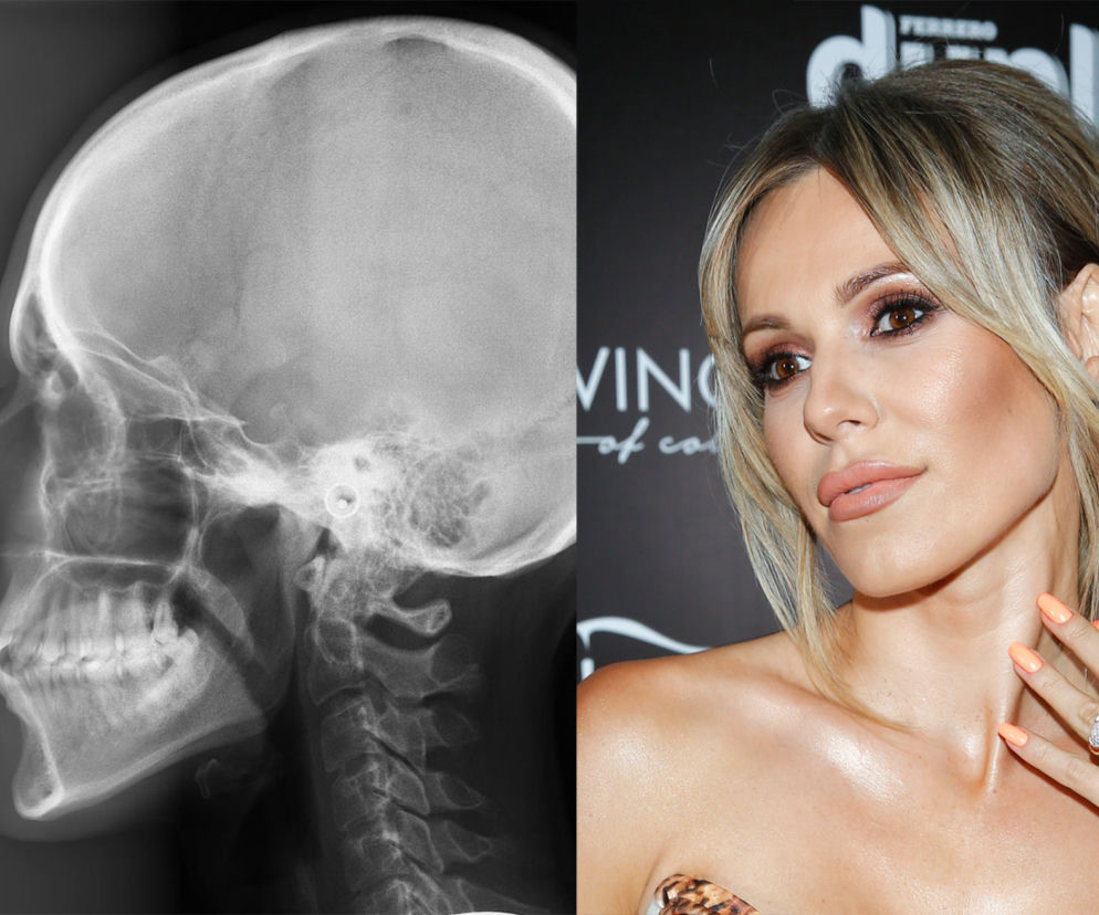 Doda udowodniła, że nie miała operacji plastycznych na twarzy