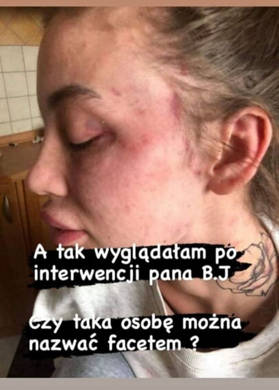 Klaudia z "Warsaw shore" pobita przez partnera?!