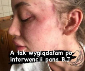 Klaudia z Warsaw shore pobita przez partnera?!