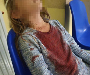 Bezdomna rzuciła kostką brukową w głowę Oliwki