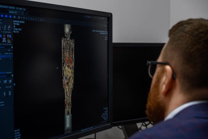 Egipska mumia trafiła do szpitala w Lublinie