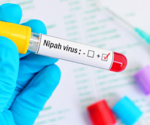 Cała prawda o nowych przypadkach Nipah. Profesor Agnieszka Szuster-Ciesielska tłumaczy, kto naprawdę jest w grupie ryzyka