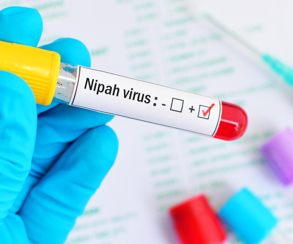 Ręka w niebieskiej rękawiczce trzyma probówkę z krwią i etykietą Nipah virus: - [ ] + [✔]. W tle widać strzykawkę oraz inne probówki. Na temat wirusa Nipah przeczytasz więcej na portalu Poradnik Zdrowie.