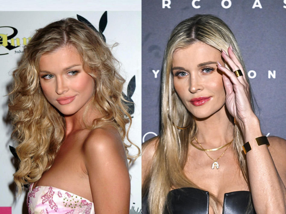 Joanna Krupa - lekarz zniszył jej twarz