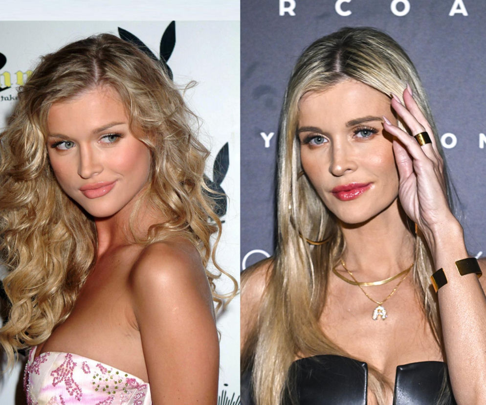 Joanna Krupa - lekarz zniszył jej twarz