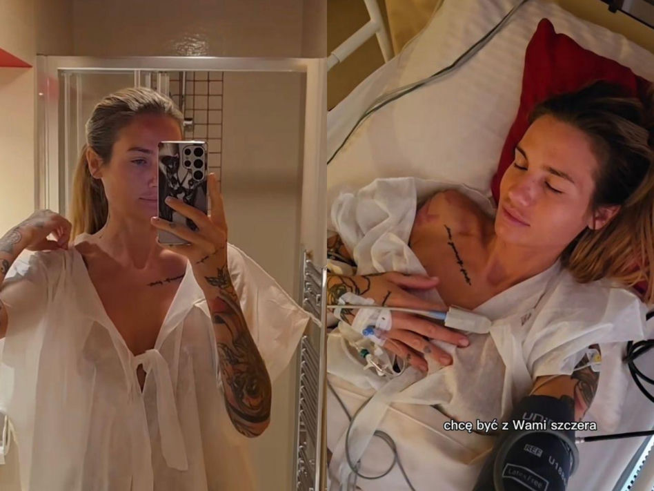 Karolina Gilon po operacji biustu. Zdjęcia przed i po