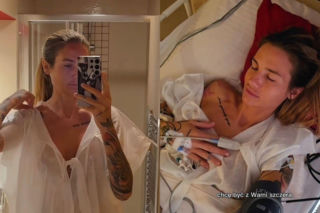 Krolina Gilon zoperowała biust. Pokazała zdjęcia przed i po operacji