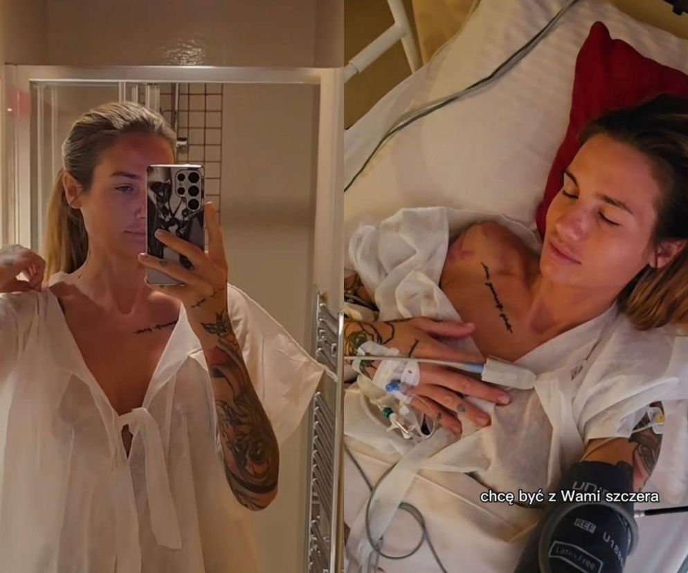 Karolina Gilon po operacji biustu. Zdjęcia przed i po