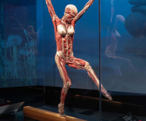 Body Worlds