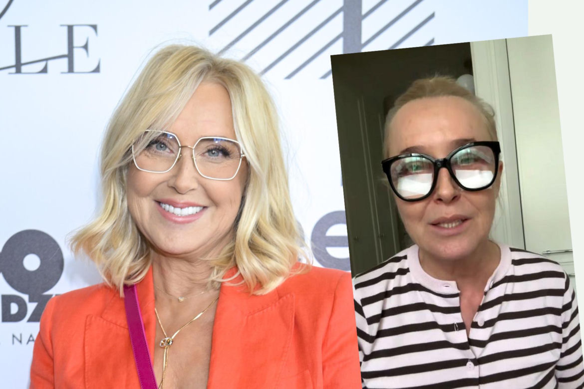 Agata Młynarska wycięła sobie powieki