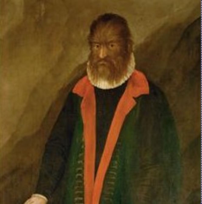Syndrom wilkołaka