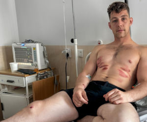 Ratownicy rozjechali biegacza? Dramat podczas półmaratonu w Ostródzie