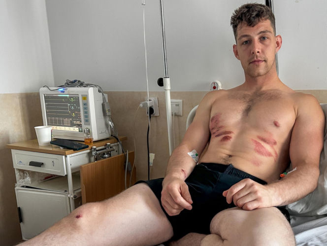 Ratownicy rozjechali biegacza? Dramat podczas półmaratonu w Ostródzie