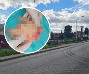 Dramat Maksa. Tasakiem odcięto mu dłoń. To były porachunki?! Drastyczne zdjęcia