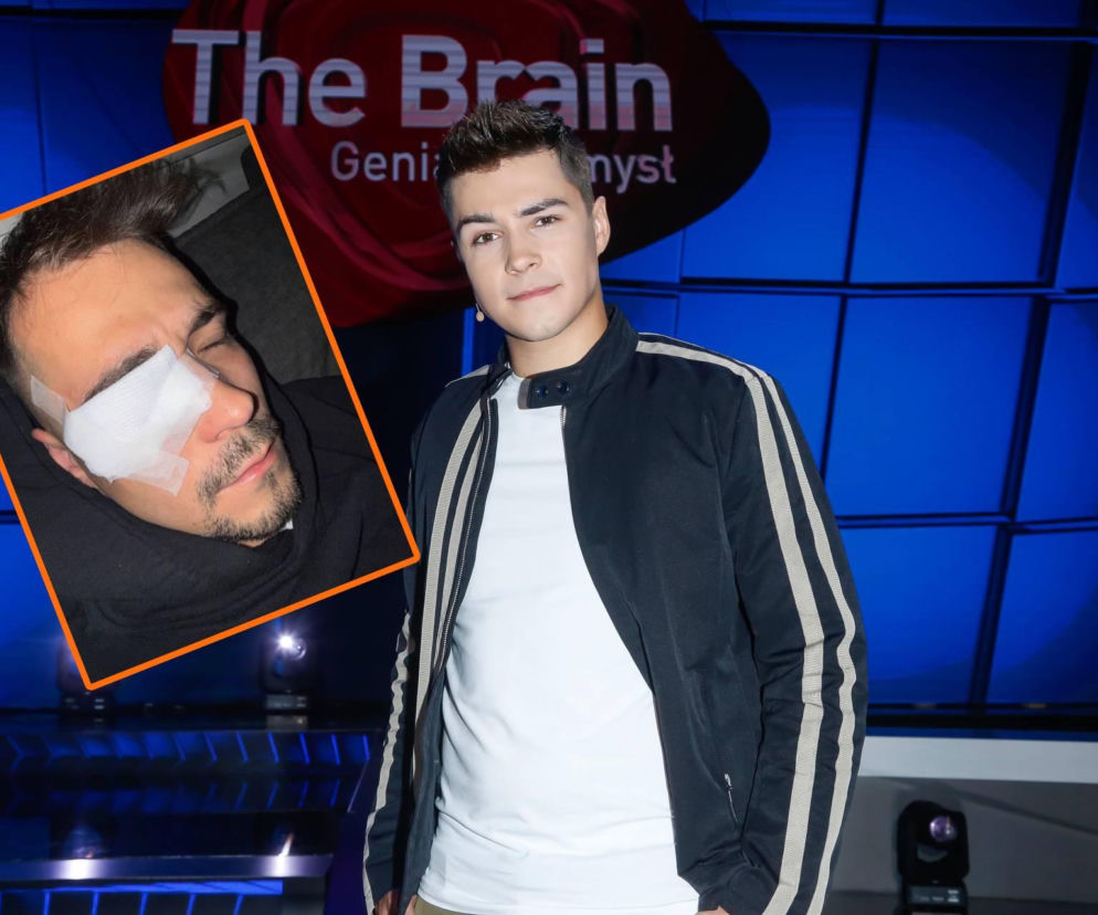 Polski influencer miał wypadek. Ucierpiało jego oko