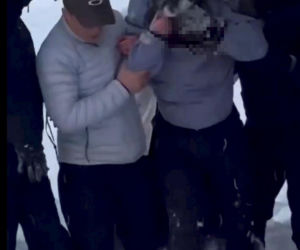 Horror na stoku. Narciarce krew się lała z twarzy. Zaatakował ją drapieżnik!