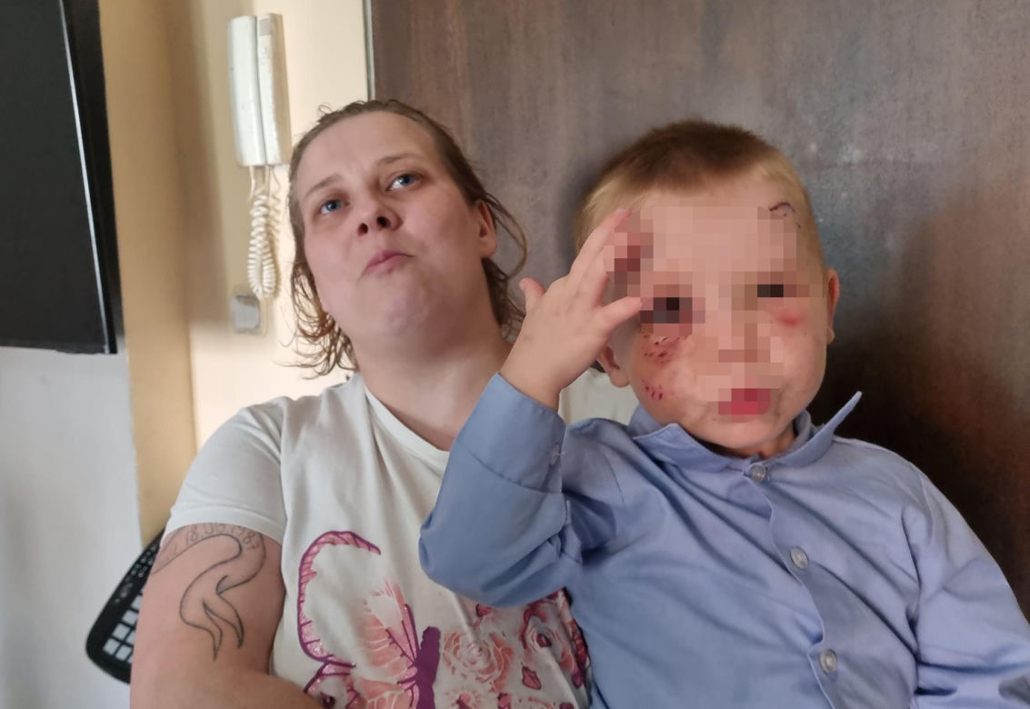 Pies pogryzł 3-latka na przystanku