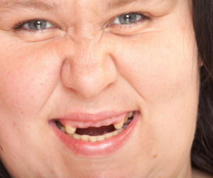 Brakuje ci zębów? To może wpływać na wagę. Dentystka tłumaczy mechanizm