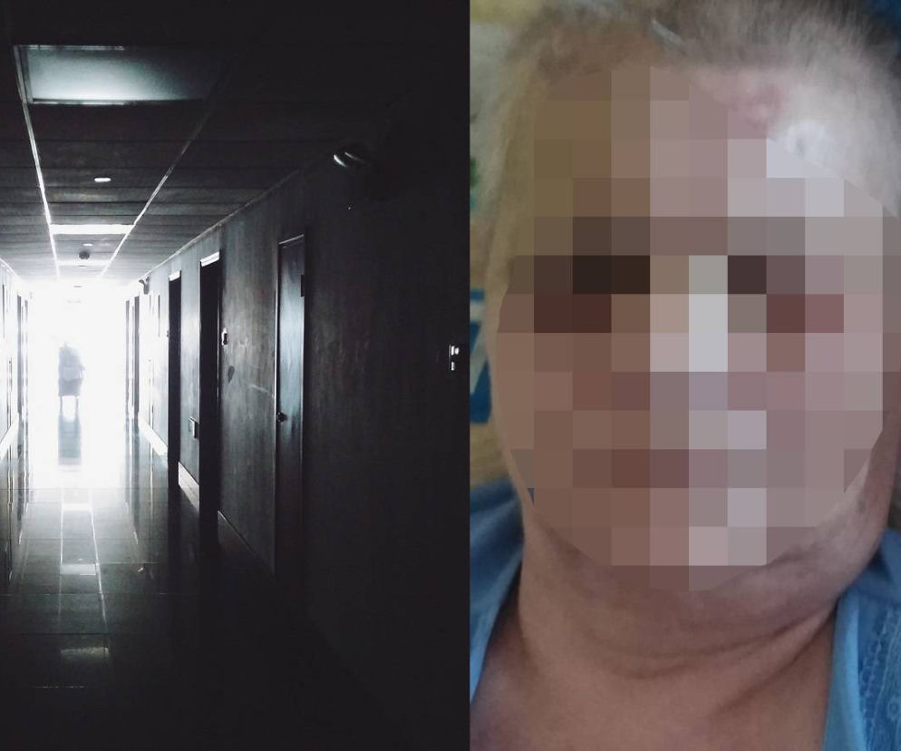 Mama pani Grażyny przeszła gehennę w szpitalu? Żenada! O jakim poświęceniu mówią lekarze?
