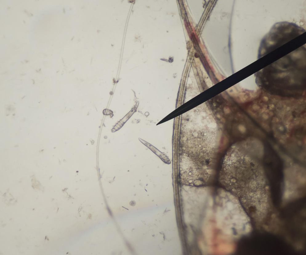 Bardzo niepokojące odkrycie nad Odrą. Polscy naukowcy znaleźli nowego pasożyta