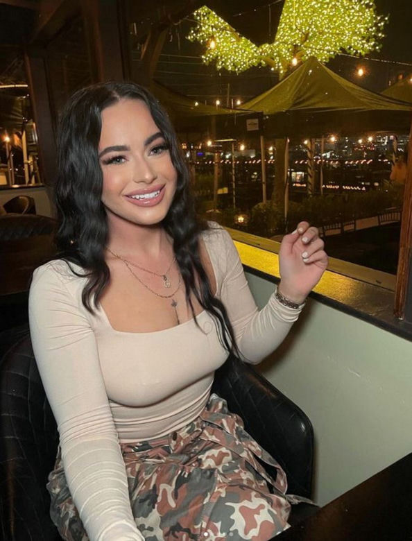 Jej usta prawie wybuchły po darmowym zabiegu. Dramat influencerki. "Najgorszy dzień w życiu"
