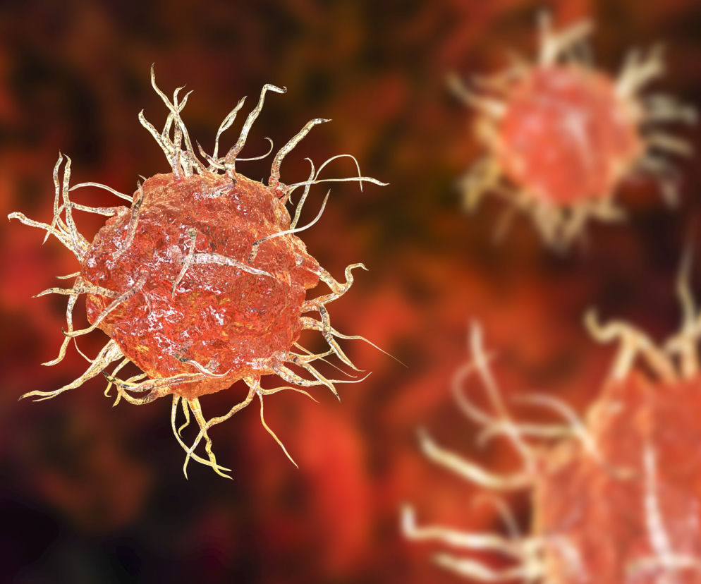 Histiocytoza