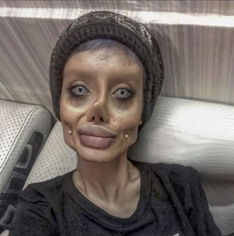 Chciała wyglądać jak Angelina Jolie