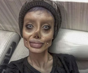 Chciała wyglądać jak Angelina Jolie