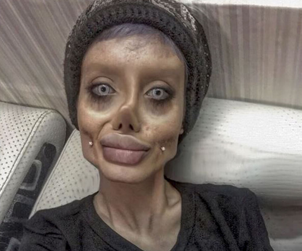 Chciała wyglądać jak Angelina Jolie