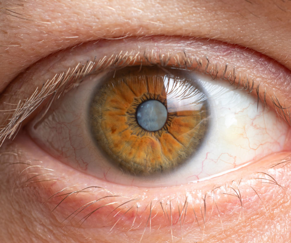 oko