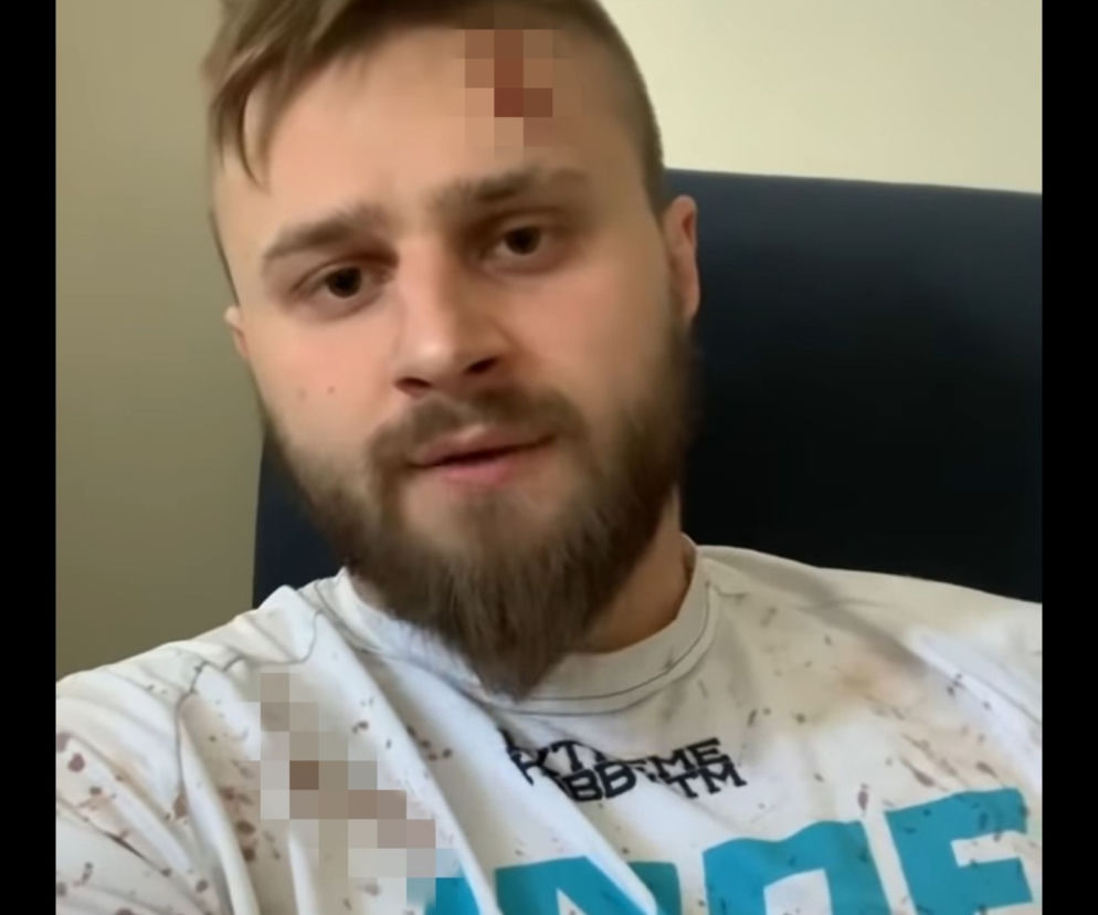 Amadeusz Ferrari Roślik zaatakowany maczetą w mieszkaniu! Co się stało zawodnikowi Fame MMA?