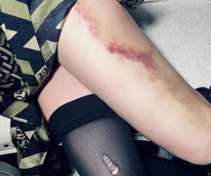 63-letnia Madonna pobita? Gwiazda opublikowała szokujące zdjęcia!