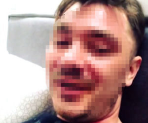 Syn Zenka dostał gazem w twarz