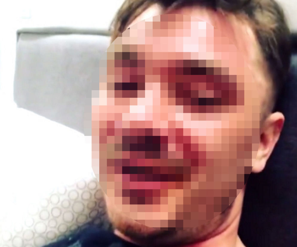 Syn Zenka dostał gazem w twarz